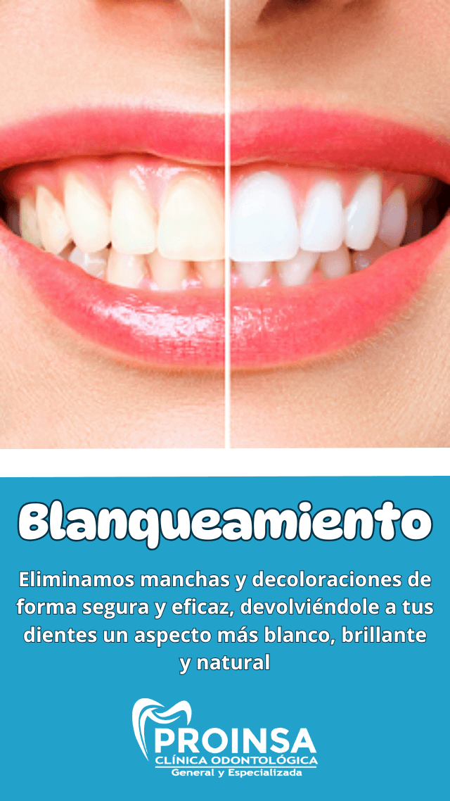 blanqueamiento
